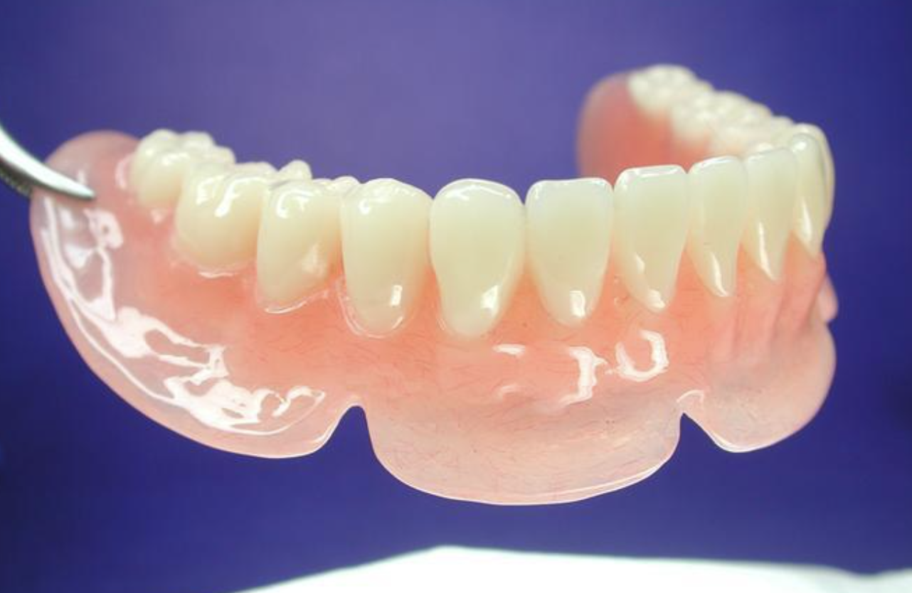 吸附性活动义齿多少钱?2026青岛口腔医院/门诊最新报价及修复流程 吸附性活动义齿多少钱?2026青岛口腔医院/门诊最新报价及修复流程