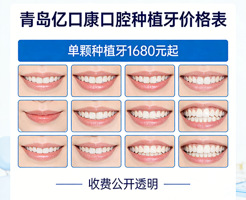 青岛亿口康口腔种植牙价格表：单颗种植牙1680元起，收费公开透明